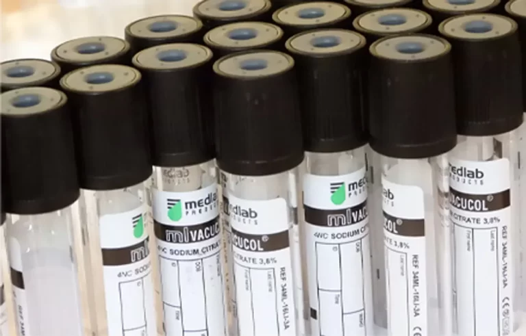 Dynamic Characterisation of MEMS